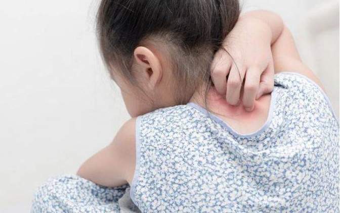 生活 | 【切勿轻信偏方】孩子一直抓痒，爸妈竟然用尿来止痒？！ 更多热点 图1张