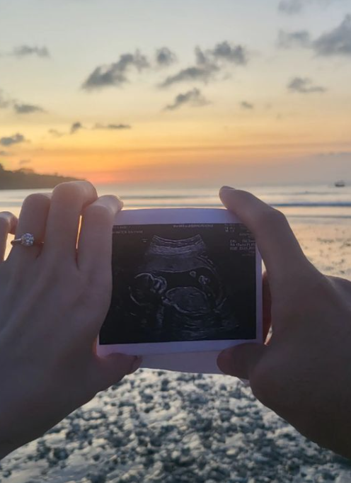 升格人妻、人母！胡佳琪表白未婚夫：遇见你 是我幸运 娱乐资讯 图1张