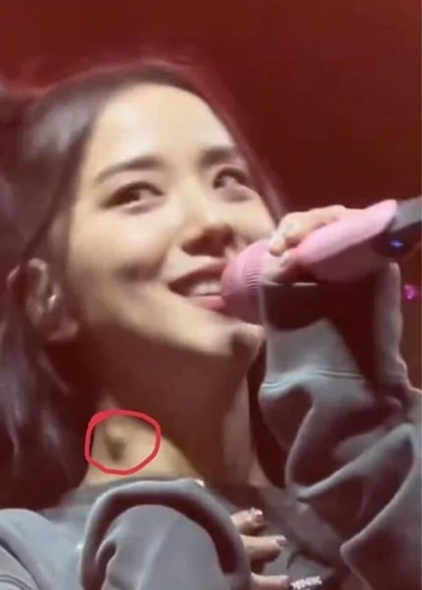 疑操劳过度！BLACKPINK Jisoo被拍到“脖子肿一块” 娱乐资讯 图1张