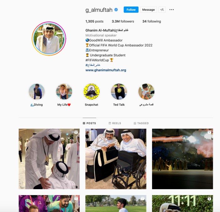 人物 I 世界杯开幕式残障男孩引注意，背后故事超励志！ 更多热点 图5张