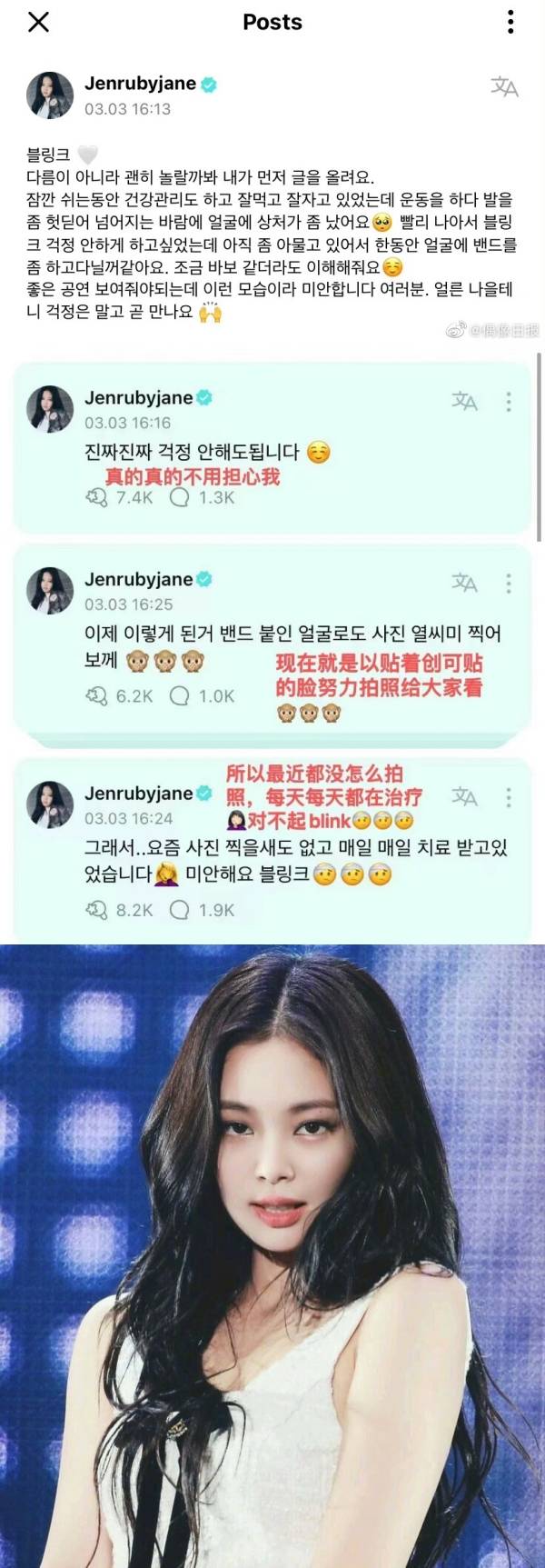 Jennie赴马来西亚开唱前受伤！“就算有点傻也请谅解” 娱乐资讯 图2张