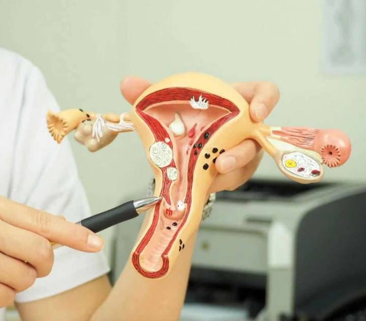 健康I Selina竟能带瘤怀孕？来正确认识子宫肌瘤是什么！ 更多热点 图2张
