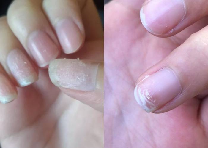 健康I 你的指甲为何比人丑？看来就是做了这5件事！ 更多热点 图3张