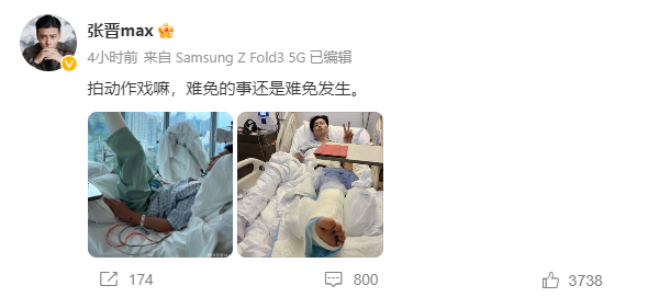 张晋左脚裹石膏、手部受伤！突入院原因曝光 娱乐资讯 图2张