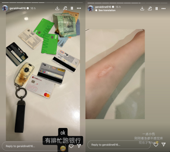Geraldine颜慧萍Powerbank家中自爆！包包被烧毁 手臂轻微烧伤！ 娱乐资讯 图2张