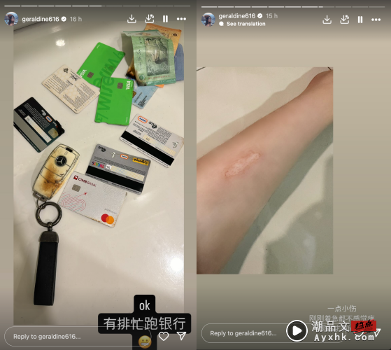 Geraldine颜慧萍Powerbank家中自爆！包包被烧毁 手臂轻微烧伤！ 娱乐资讯 图2张