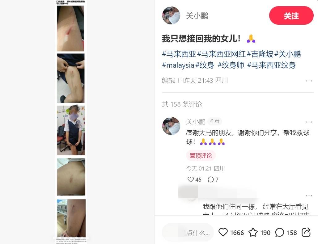 前夫贴女儿验伤报告、视频！马来西亚纹身师Kinki亲自回应 娱乐资讯 图2张