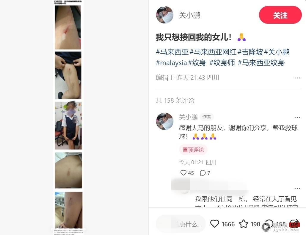 前夫贴女儿验伤报告、视频！马来西亚纹身师Kinki亲自回应 娱乐资讯 图2张