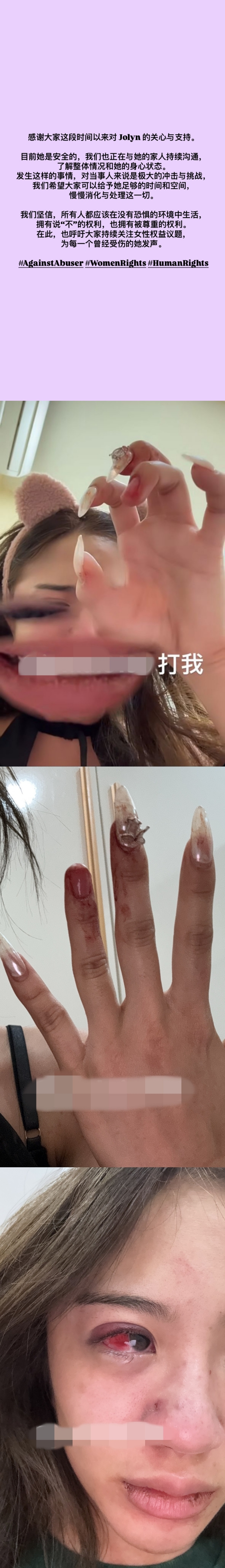 两周前疑遭家暴！Jolyn曝光现况 声明：不会再回应此事！ 娱乐资讯 图3张