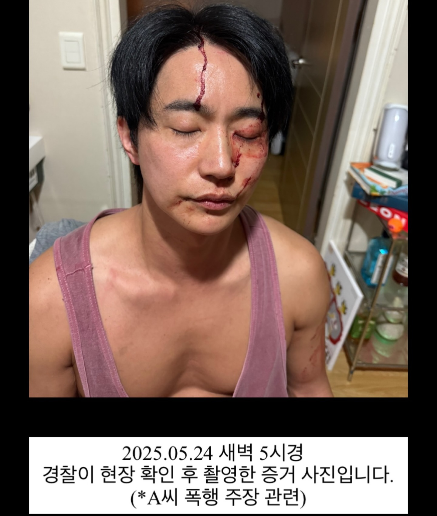 遭前女友控家暴、传染性病！韩国男星晒爆头照反击！ 娱乐资讯 图4张