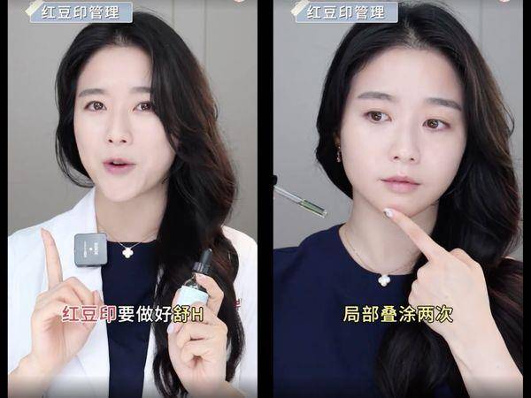 痘疤比痘痘更难搞！皮肤科医师教“正确去痘印”护理4重点 最新资讯 图3张