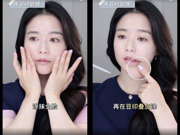 痘疤比痘痘更难搞！皮肤科医师教“正确去痘印”护理4重点 最新资讯 图4张