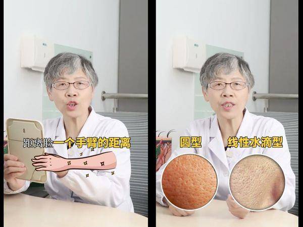 皮肤科医师教“改善毛孔”2种保养法！水滴型毛孔首重抗老 最新资讯 图2张