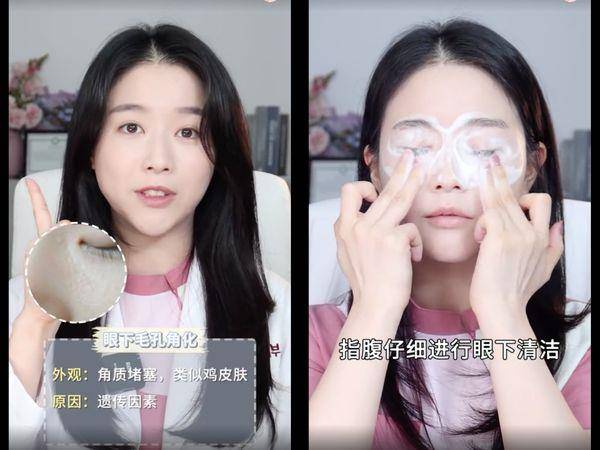 皮肤科医师教7种“眼下颗粒”判别法！第1种靠正确保养能改善 最新资讯 图2张