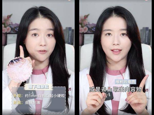 皮肤科医师教7种“眼下颗粒”判别法！第1种靠正确保养能改善 最新资讯 图4张