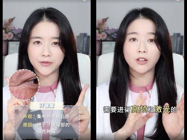 皮肤科医师教7种“眼下颗粒”判别法！第1种靠正确保养能改善 最新资讯 图7张