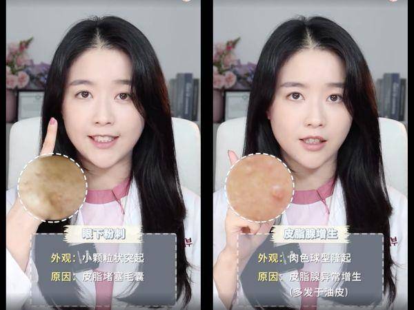 皮肤科医师教7种“眼下颗粒”判别法！第1种靠正确保养能改善 最新资讯 图6张