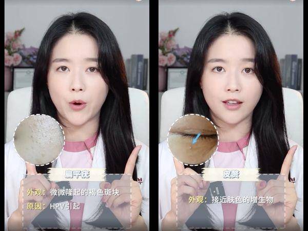 皮肤科医师教7种“眼下颗粒”判别法！第1种靠正确保养能改善 最新资讯 图5张