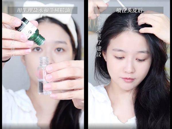 生理盐水也能护肤？皮肤科医师教“5招保养妙用”：秒变舒缓面膜 最新资讯 图3张