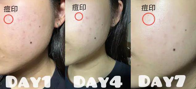 第1支爆亮精华“净亮4大暗区”！全网好评：14天肌肤有感爆亮 最新资讯 图7张
