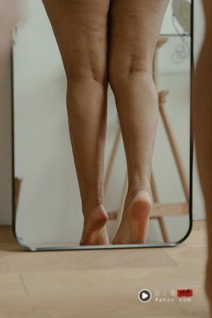 纤细女生也可能会有！“4个状况”让你大腿橘皮冒出来 最新资讯 图2张